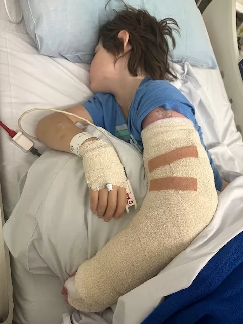 Child sleeping in a hospital bed with his arm and taped in a cast